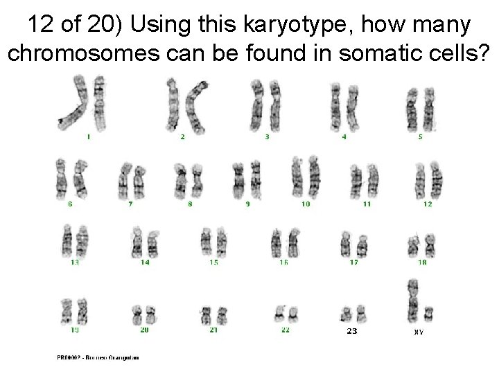 12 of 20) Using this karyotype, how many chromosomes can be found in somatic