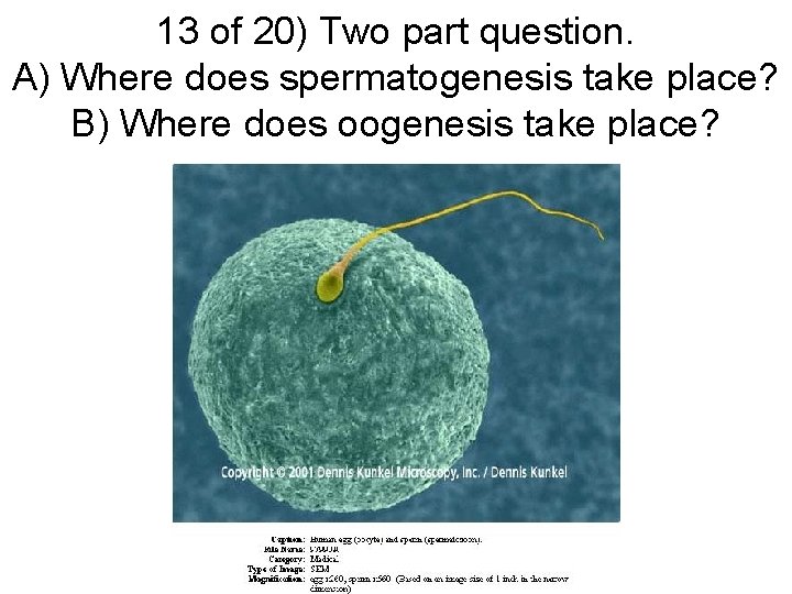 13 of 20) Two part question. A) Where does spermatogenesis take place? B) Where