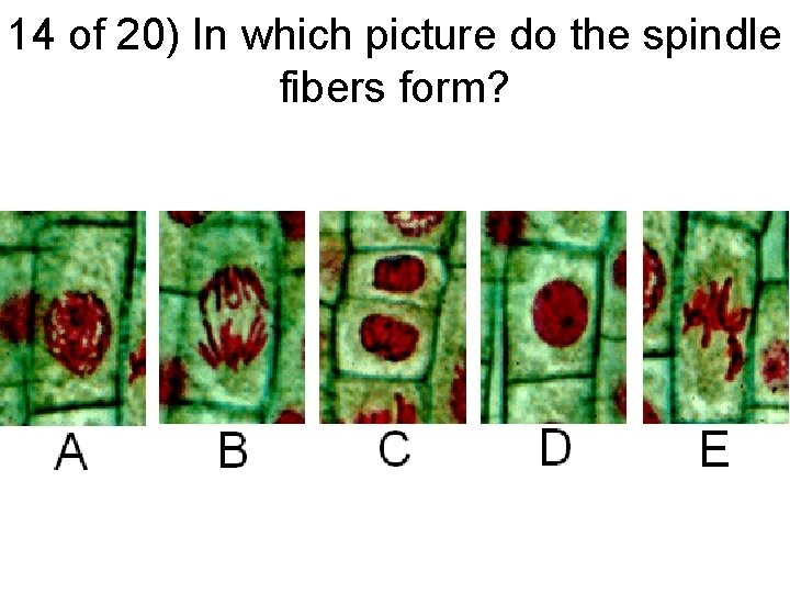 14 of 20) In which picture do the spindle fibers form? 