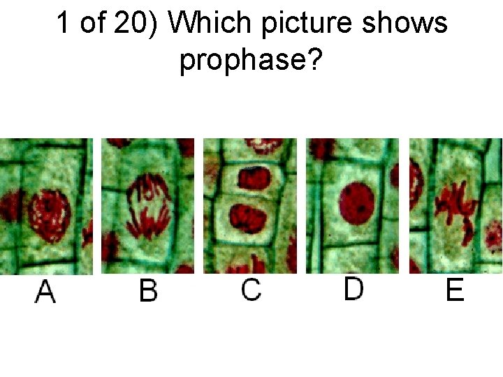 1 of 20) Which picture shows prophase? 