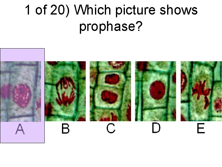 1 of 20) Which picture shows prophase? 