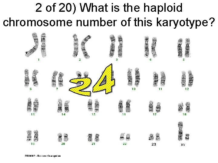 2 of 20) What is the haploid chromosome number of this karyotype? 