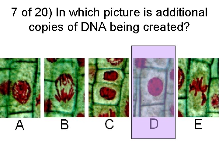 7 of 20) In which picture is additional copies of DNA being created? 