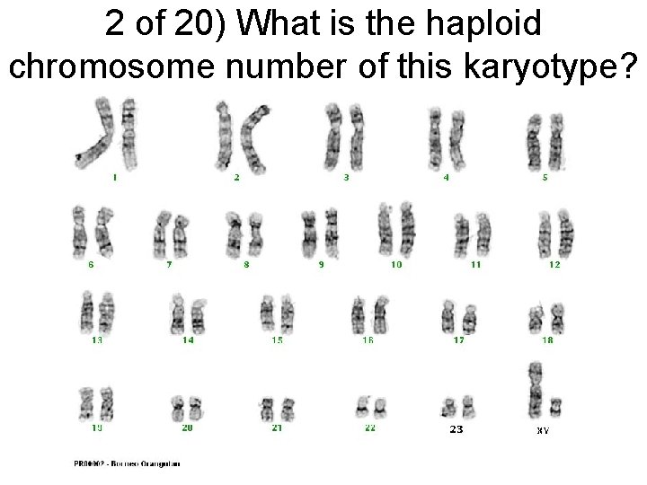 2 of 20) What is the haploid chromosome number of this karyotype? 