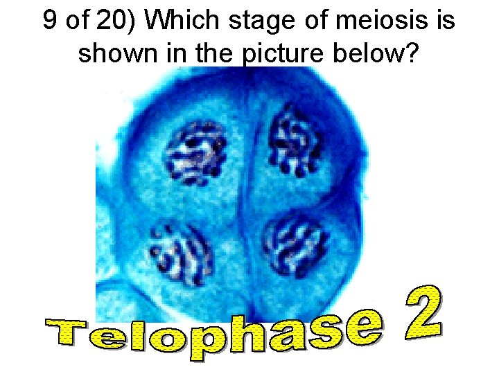 9 of 20) Which stage of meiosis is shown in the picture below? 