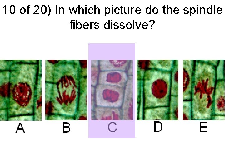 10 of 20) In which picture do the spindle fibers dissolve? 