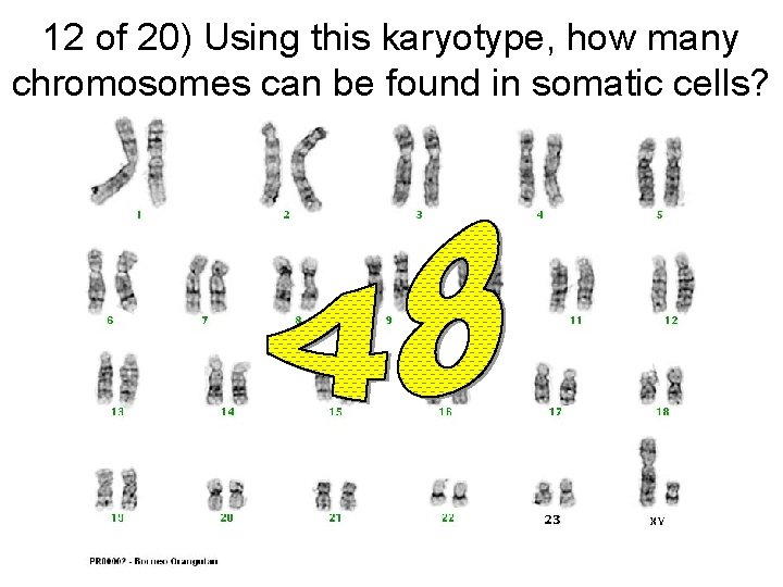 12 of 20) Using this karyotype, how many chromosomes can be found in somatic