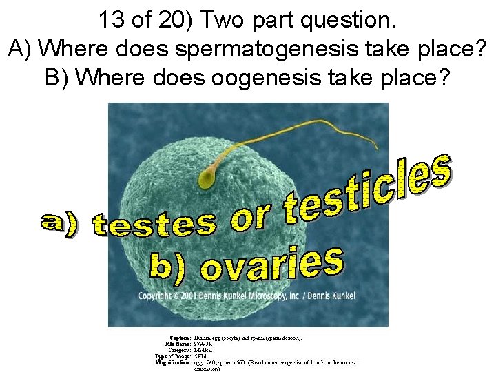 13 of 20) Two part question. A) Where does spermatogenesis take place? B) Where