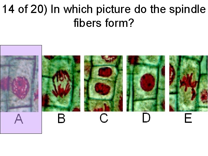 14 of 20) In which picture do the spindle fibers form? 