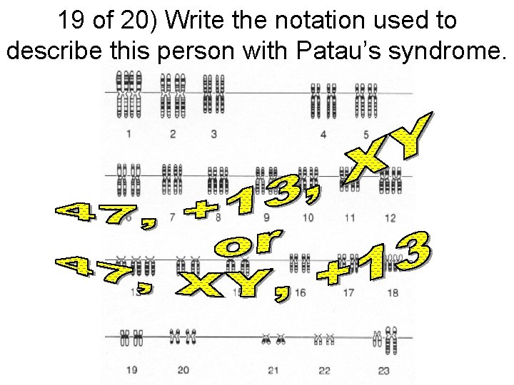 19 of 20) Write the notation used to describe this person with Patau’s syndrome.