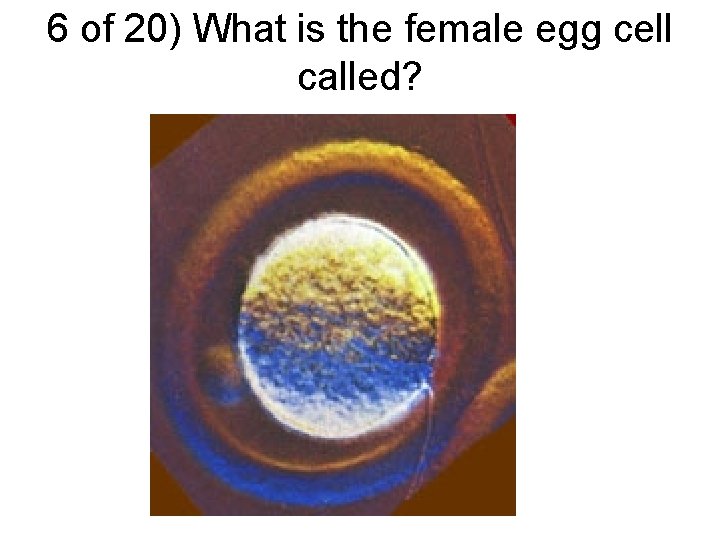 6 of 20) What is the female egg cell called? 