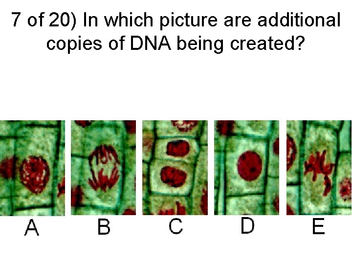 7 of 20) In which picture additional copies of DNA being created? 