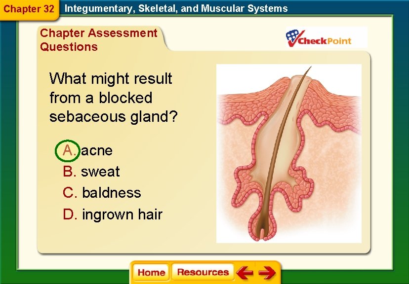 Chapter 32 Integumentary, Skeletal, and Muscular Systems Chapter Assessment Questions What might result from