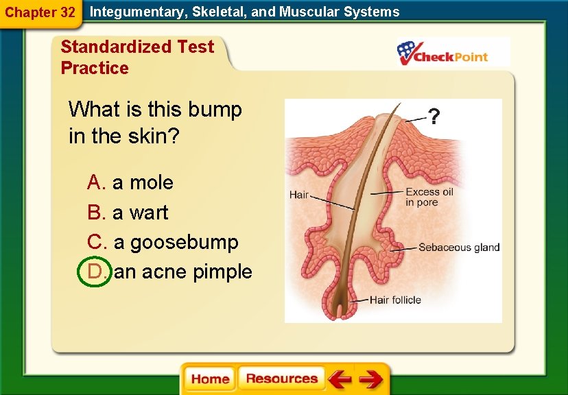 Chapter 32 Integumentary, Skeletal, and Muscular Systems Standardized Test Practice What is this bump