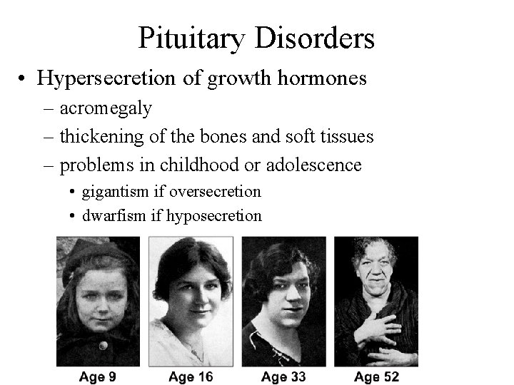 Pituitary Disorders • Hypersecretion of growth hormones – acromegaly – thickening of the bones