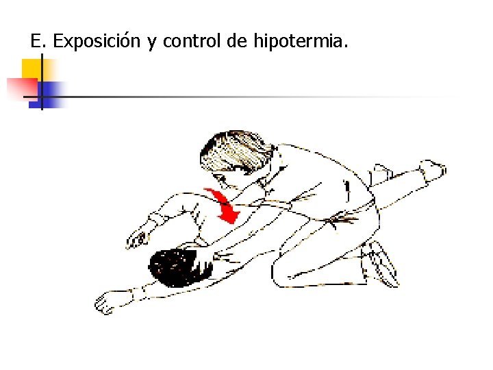 E. Exposición y control de hipotermia. 