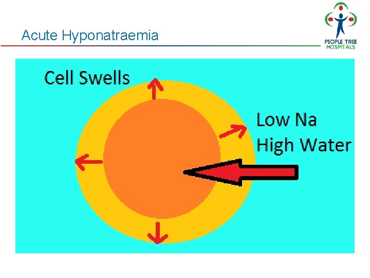 Acute Hyponatraemia Acute Hyponatraemia