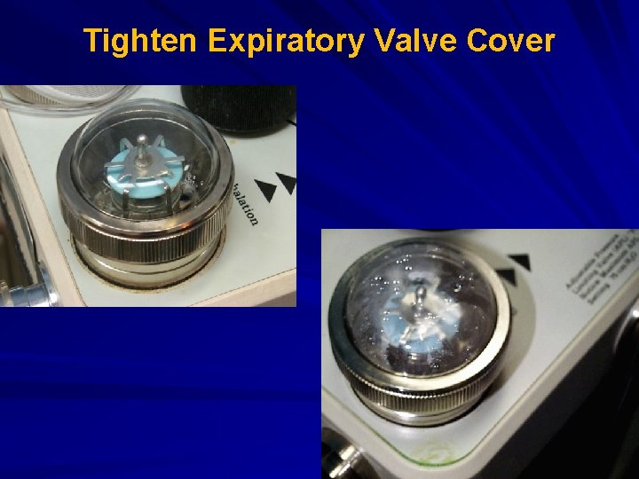 Tighten Expiratory Valve Cover 