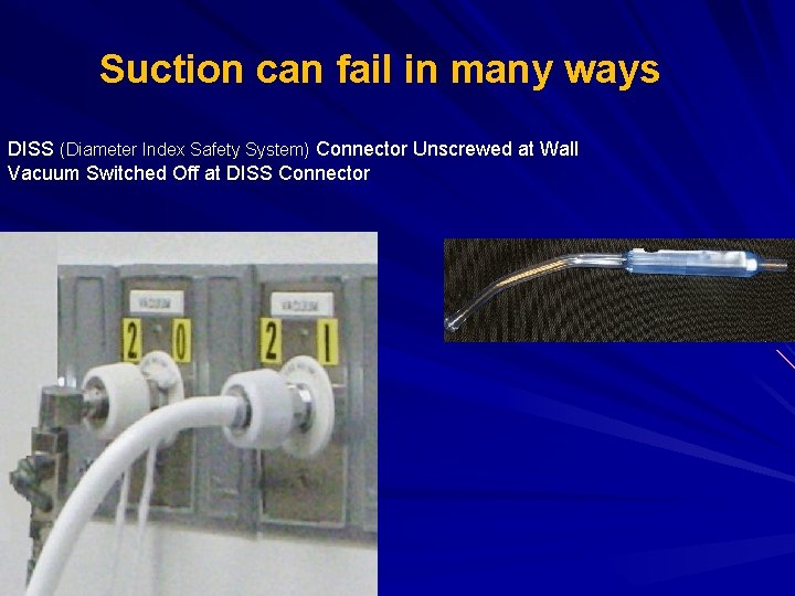 Suction can fail in many ways DISS (Diameter Index Safety System) Connector Unscrewed at