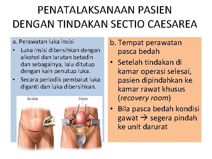 PENATALAKSANAAN PASIEN DENGAN TINDAKAN SECTIO CAESAREA a. Perawatan luka insisi • Luka insisi dibersihkan