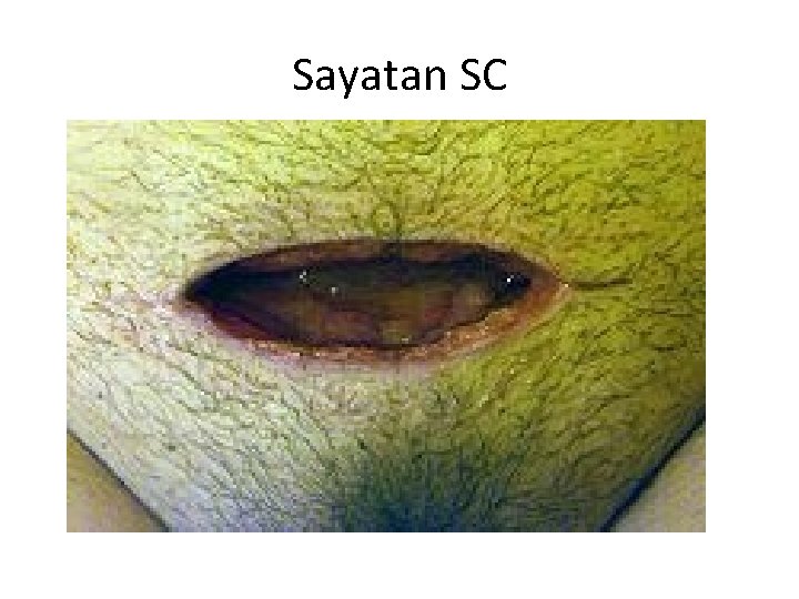 Sayatan SC 