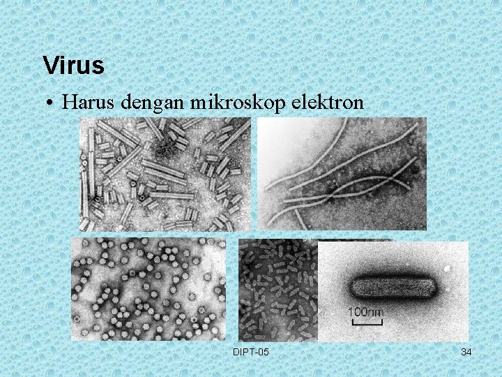 Virus • Harus dengan mikroskop elektron DIPT-05 34 