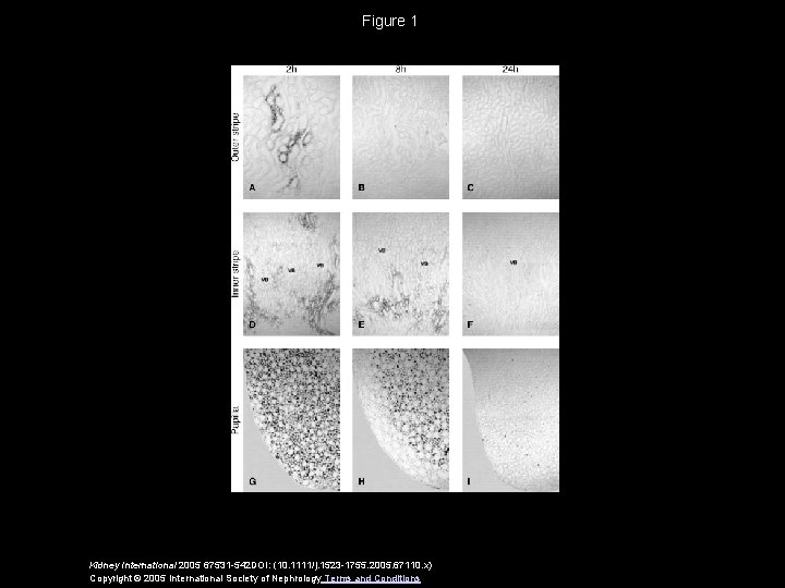 Figure 1 Kidney International 2005 67531 -542 DOI: (10. 1111/j. 1523 -1755. 2005. 67110.