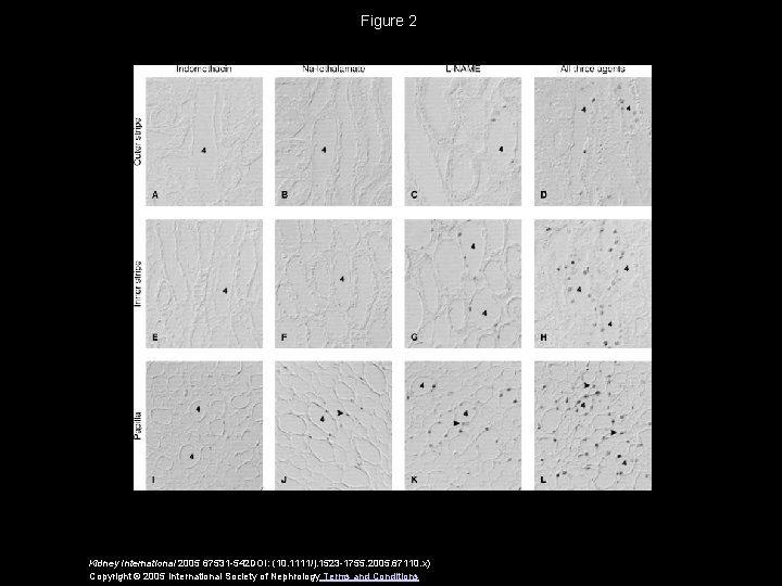 Figure 2 Kidney International 2005 67531 -542 DOI: (10. 1111/j. 1523 -1755. 2005. 67110.