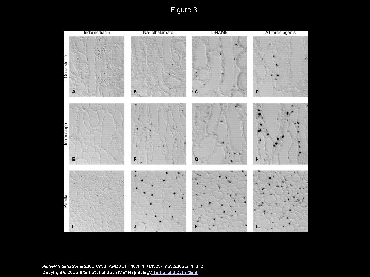 Figure 3 Kidney International 2005 67531 -542 DOI: (10. 1111/j. 1523 -1755. 2005. 67110.