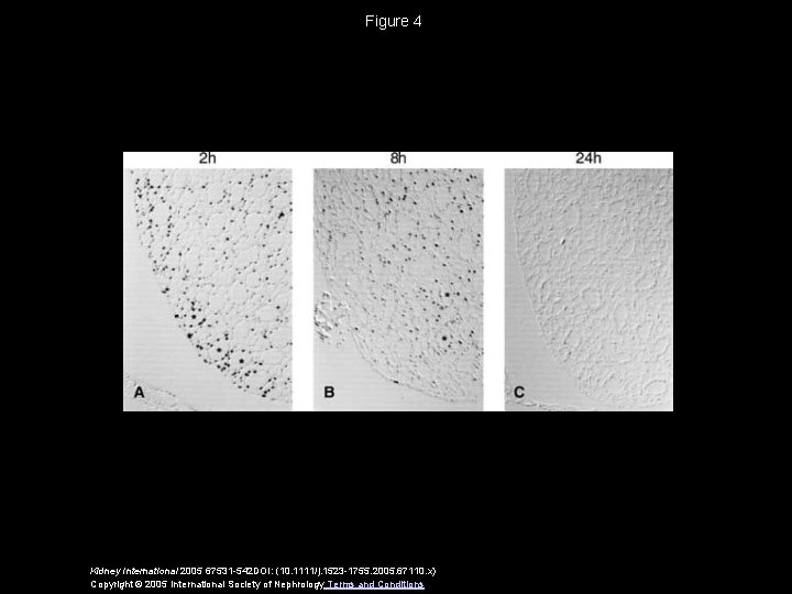 Figure 4 Kidney International 2005 67531 -542 DOI: (10. 1111/j. 1523 -1755. 2005. 67110.