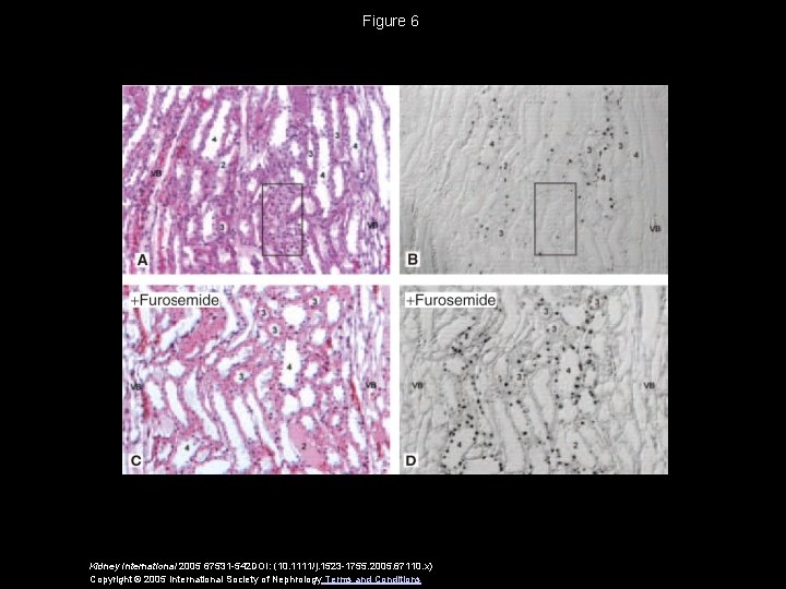 Figure 6 Kidney International 2005 67531 -542 DOI: (10. 1111/j. 1523 -1755. 2005. 67110.