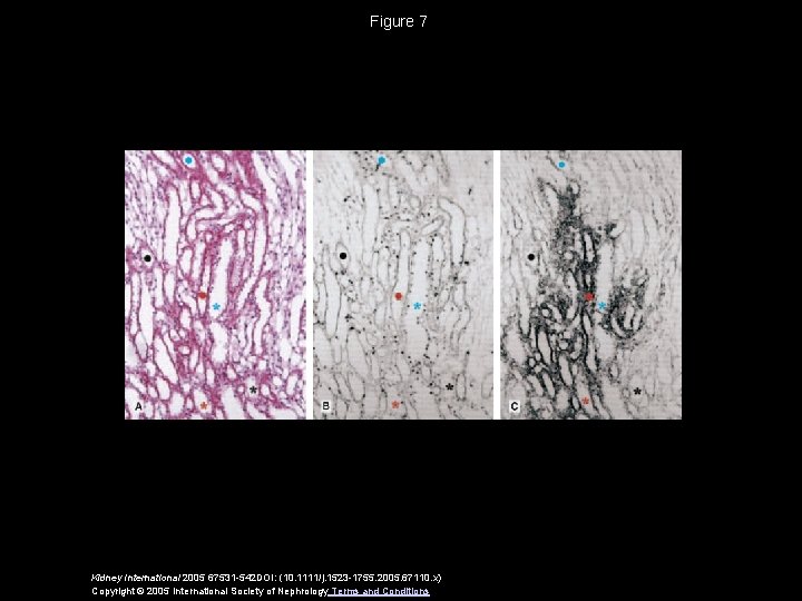 Figure 7 Kidney International 2005 67531 -542 DOI: (10. 1111/j. 1523 -1755. 2005. 67110.