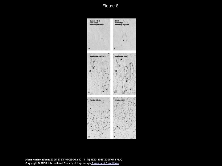 Figure 8 Kidney International 2005 67531 -542 DOI: (10. 1111/j. 1523 -1755. 2005. 67110.