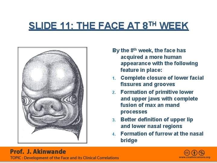 SLIDE 11: THE FACE AT 8 TH WEEK By the 8 th week, the