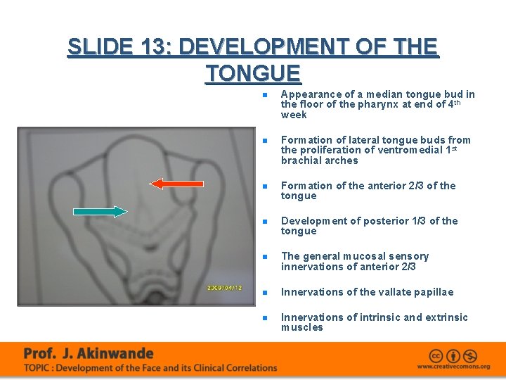 SLIDE 13: DEVELOPMENT OF THE TONGUE n Appearance of a median tongue bud in