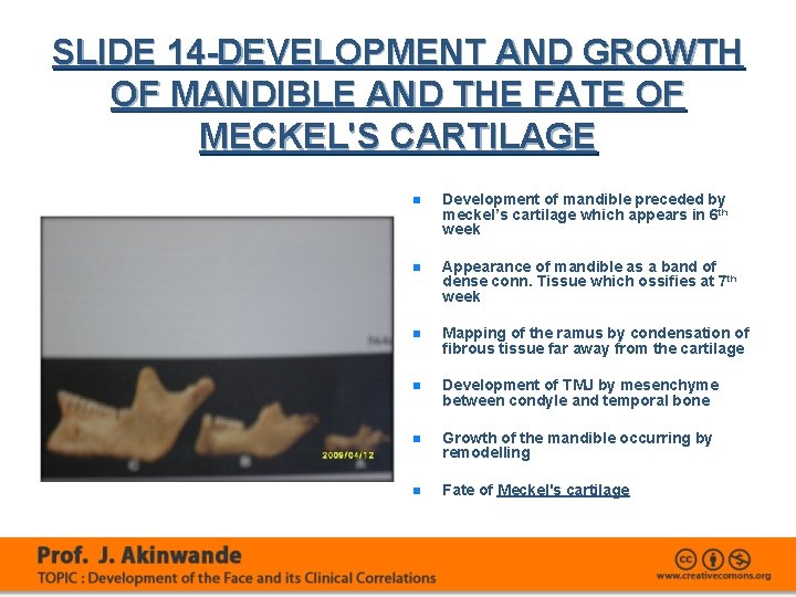 SLIDE 14 -DEVELOPMENT AND GROWTH OF MANDIBLE AND THE FATE OF MECKEL'S CARTILAGE n