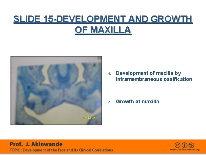 SLIDE 15 -DEVELOPMENT AND GROWTH OF MAXILLA 1. Development of maxilla by intramembraneous ossification