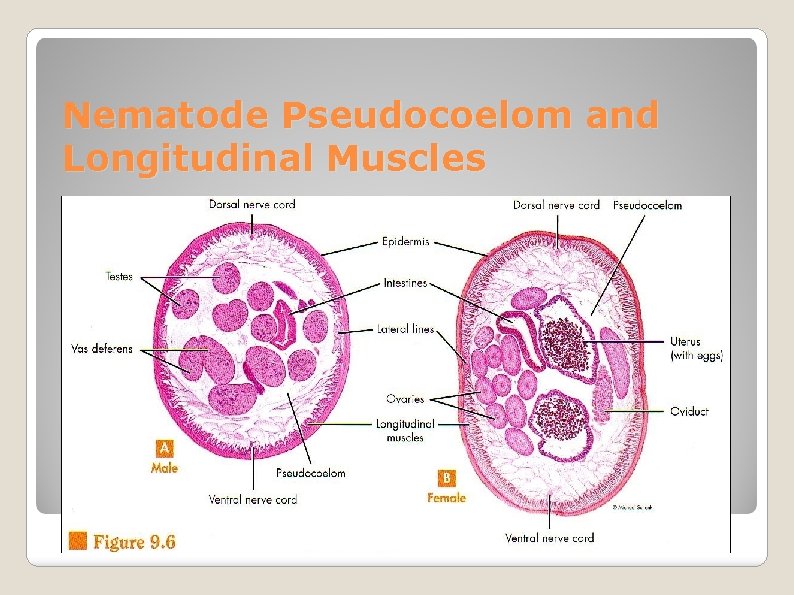 Nematode Pseudocoelom and Longitudinal Muscles 
