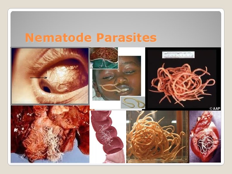 Nematode Parasites 