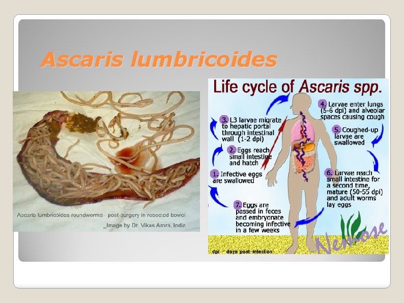 Ascaris lumbricoides 