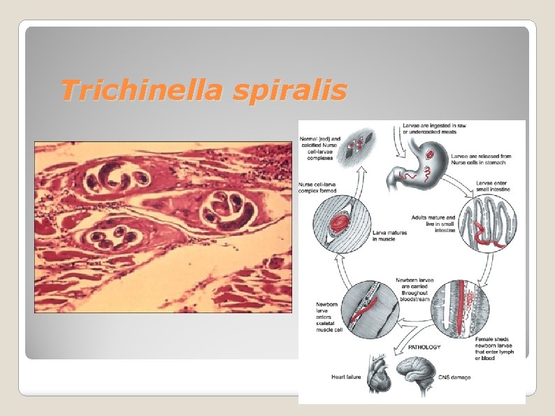 Trichinella spiralis 
