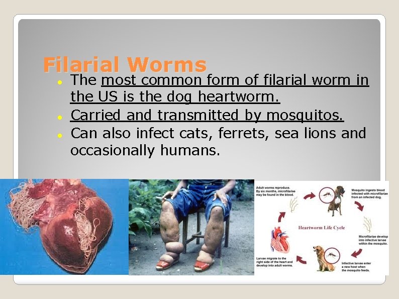 Filarial Worms The most common form of filarial worm in the US is the
