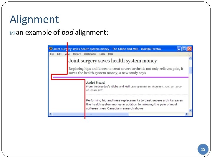 Alignment an example of bad alignment: 25 