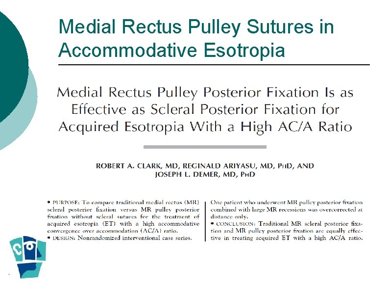 Medial Rectus Pulley Sutures in Accommodative Esotropia 
