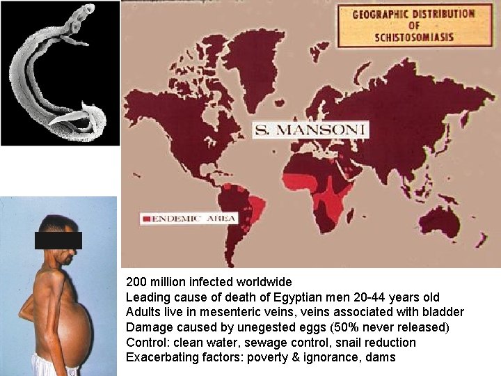 200 million infected worldwide Leading cause of death of Egyptian men 20 -44 years