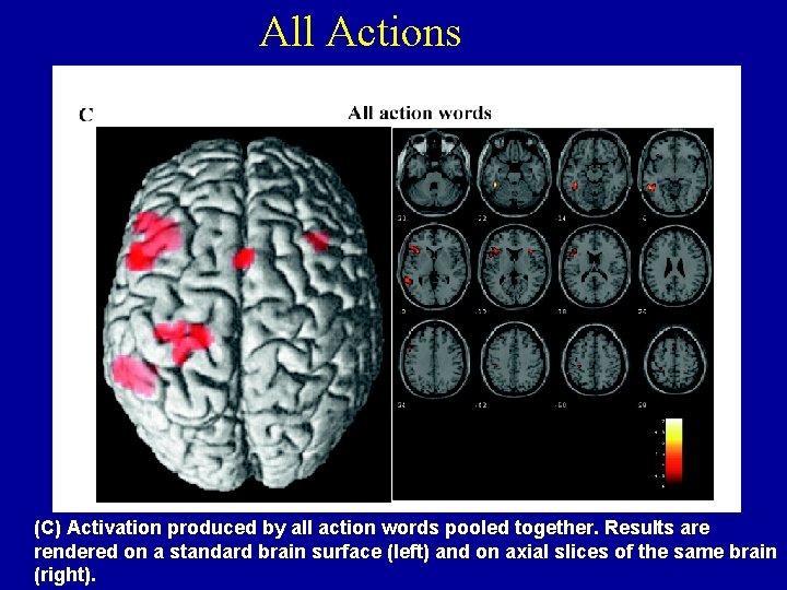 All Actions (C) Activation produced by all action words pooled together. Results are rendered