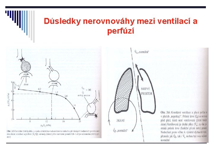 Důsledky nerovnováhy mezi ventilací a perfúzí 