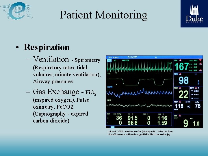 Patient Monitoring • Respiration – Ventilation - Spirometry (Respiratory rates, tidal volumes, minute ventilation), Patient Monitoring • Respiration – Ventilation - Spirometry (Respiratory rates, tidal volumes, minute ventilation),