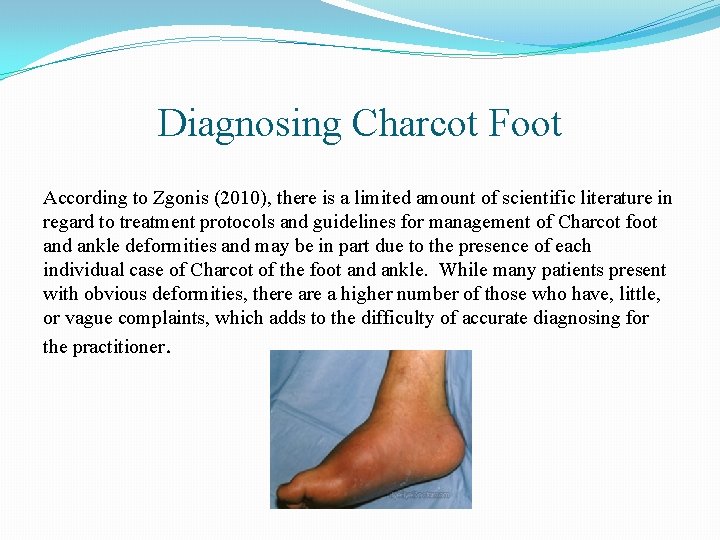 Diagnosing Charcot Foot According to Zgonis (2010), there is a limited amount of scientific