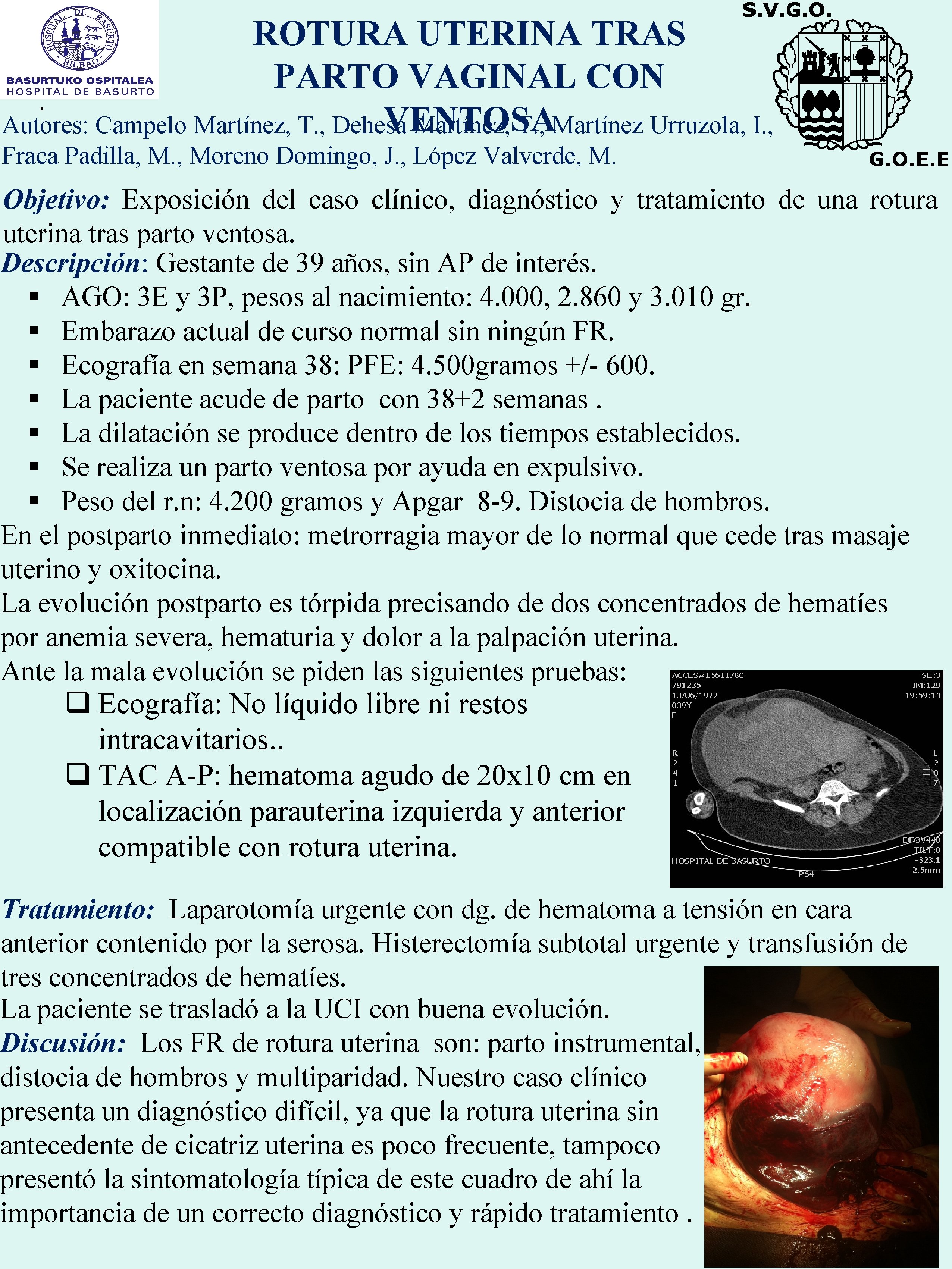 ROTURA UTERINA TRAS PARTO VAGINAL CON. VENTOSA Autores: Campelo Martínez, T. , Dehesa Martínez,